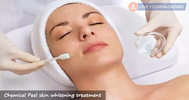 Chemical Peel skin whitening treatment - Livedownloading